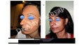 Manufacturers Exporters and Wholesale Suppliers of Face Lift Surgery New Delhi Delhi